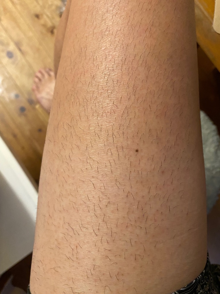 全体のレビュー画像 | 11-0