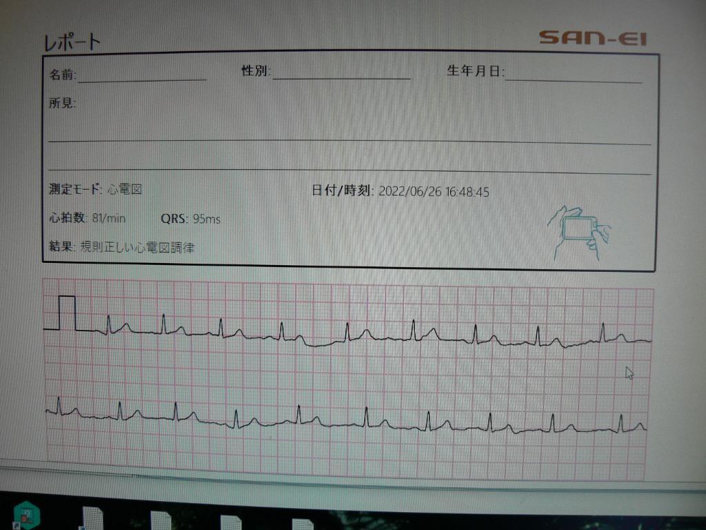 チェックミーECG アドバンスモデル 心電計 携帯型心電計 携帯用 家庭用 心電図計 ブルートゥース搭載