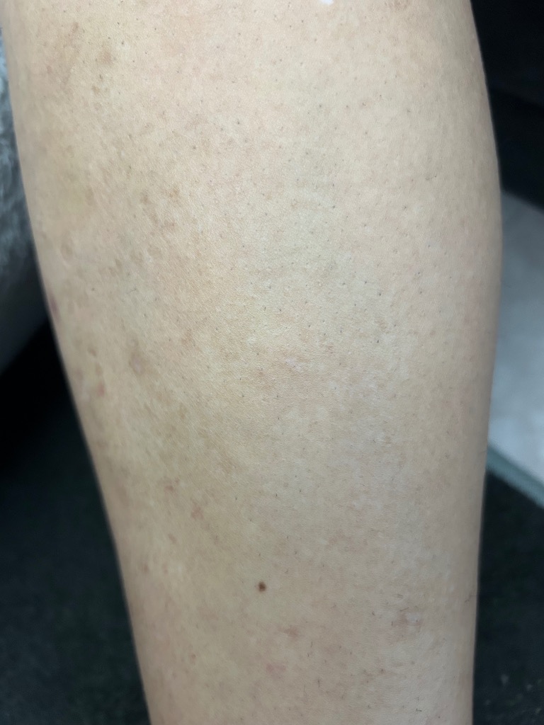 全体のレビュー画像 | 6-2