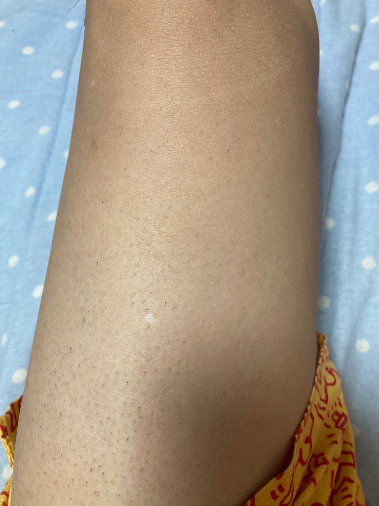 全体のレビュー画像 | 8-0