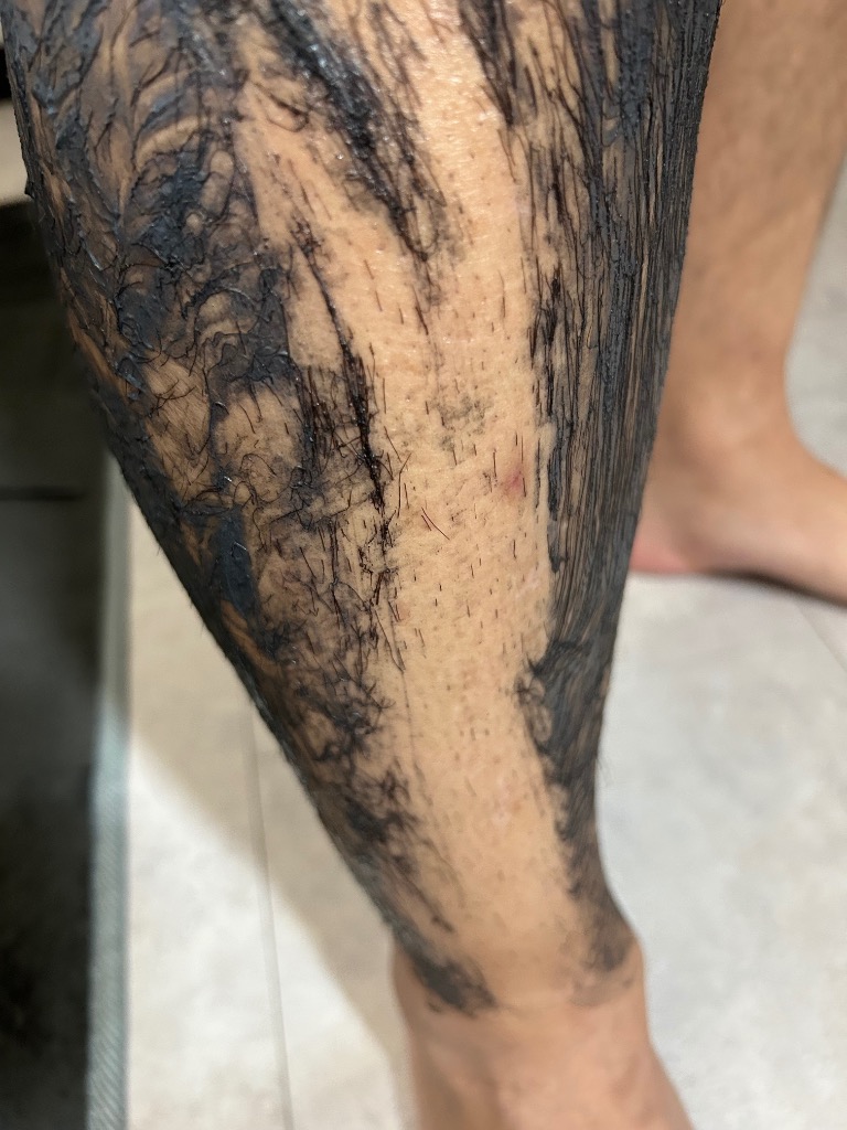 全体のレビュー画像 | 6-1