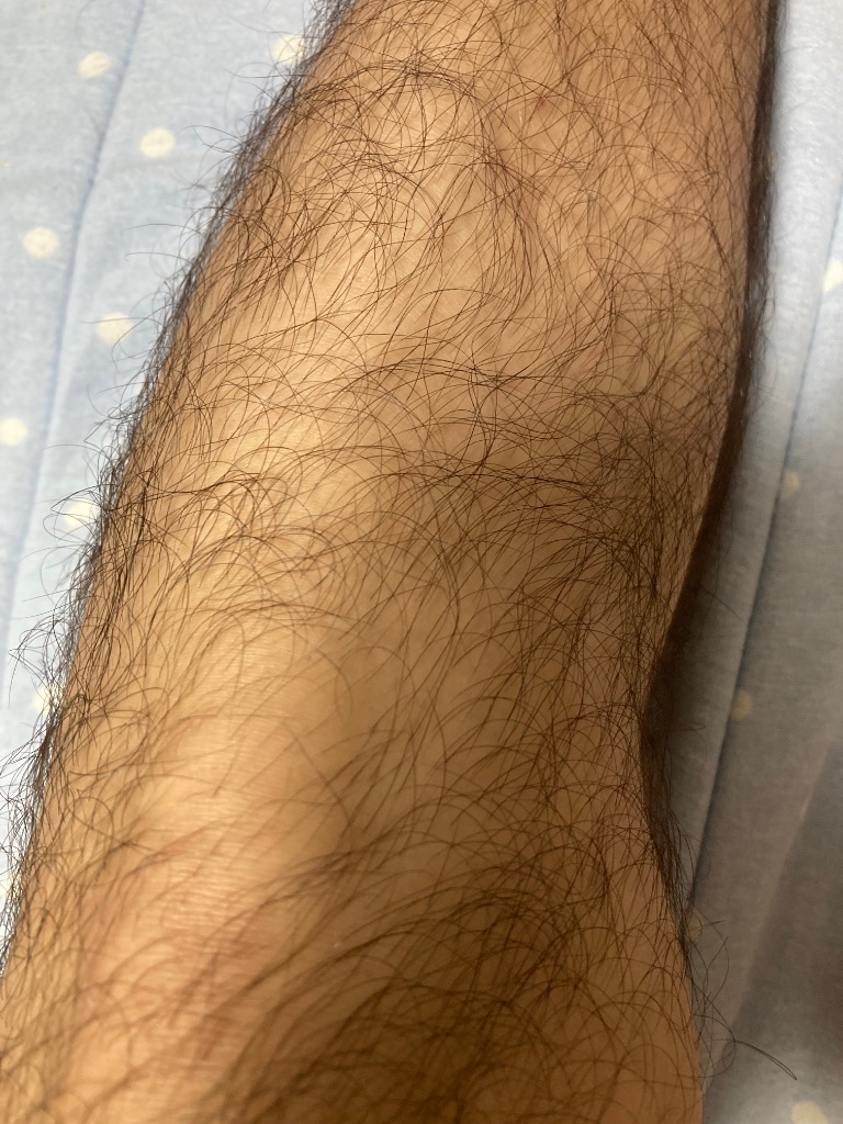 全体のレビュー画像 | 8-1