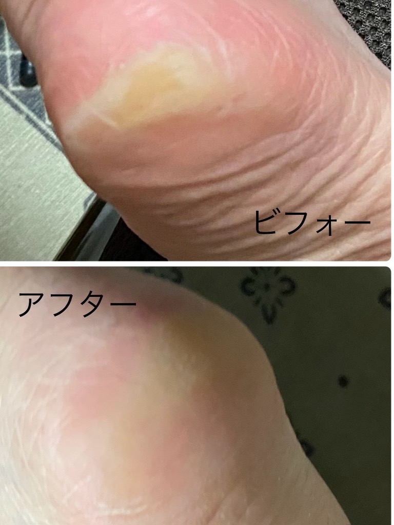 レビュー画像