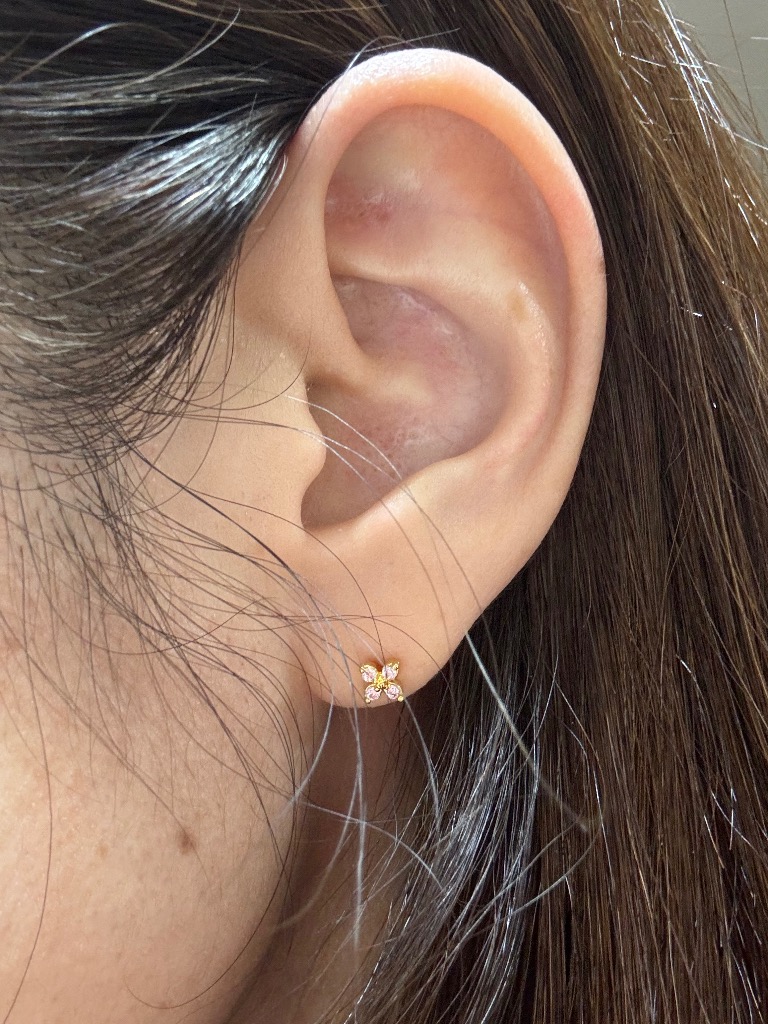 全体のレビュー画像 | 4-1