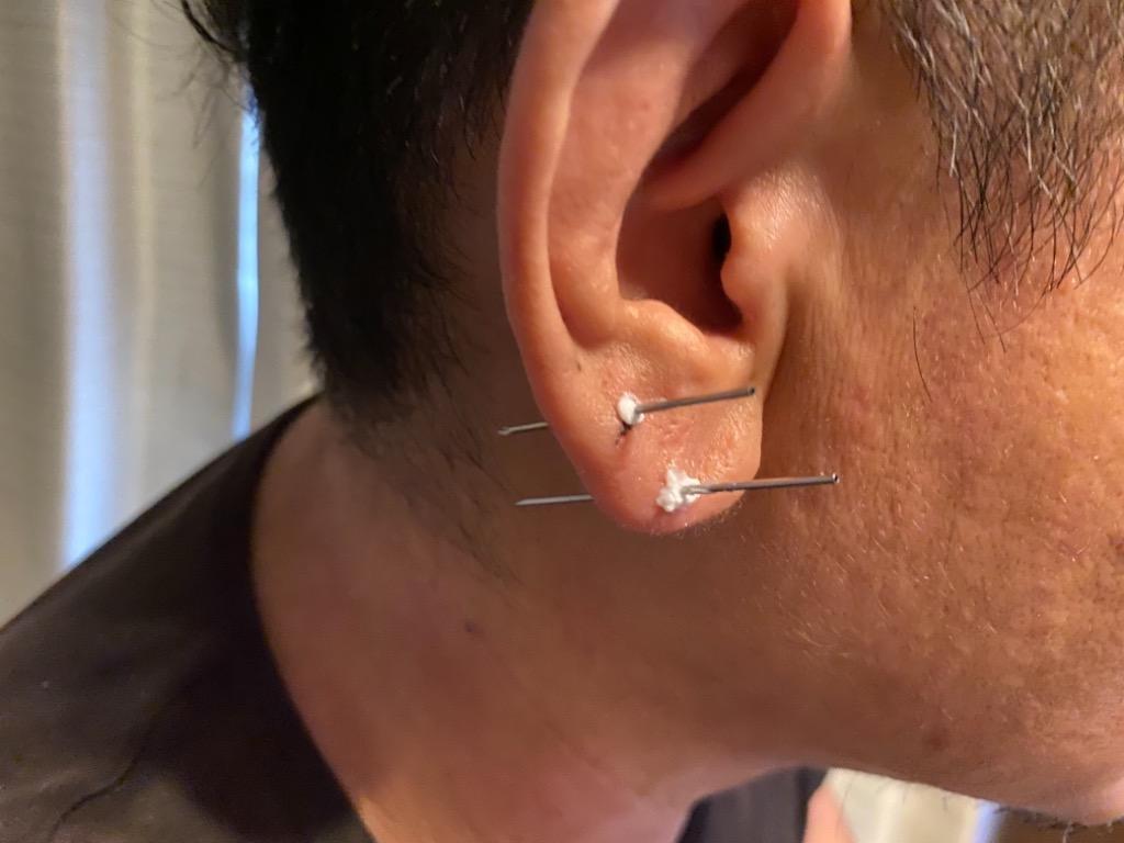 全体のレビュー画像 | 2-1