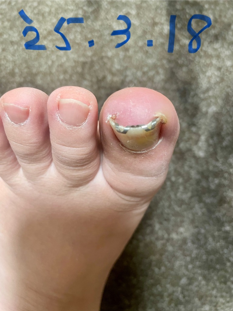 全体のレビュー画像 | 3-1