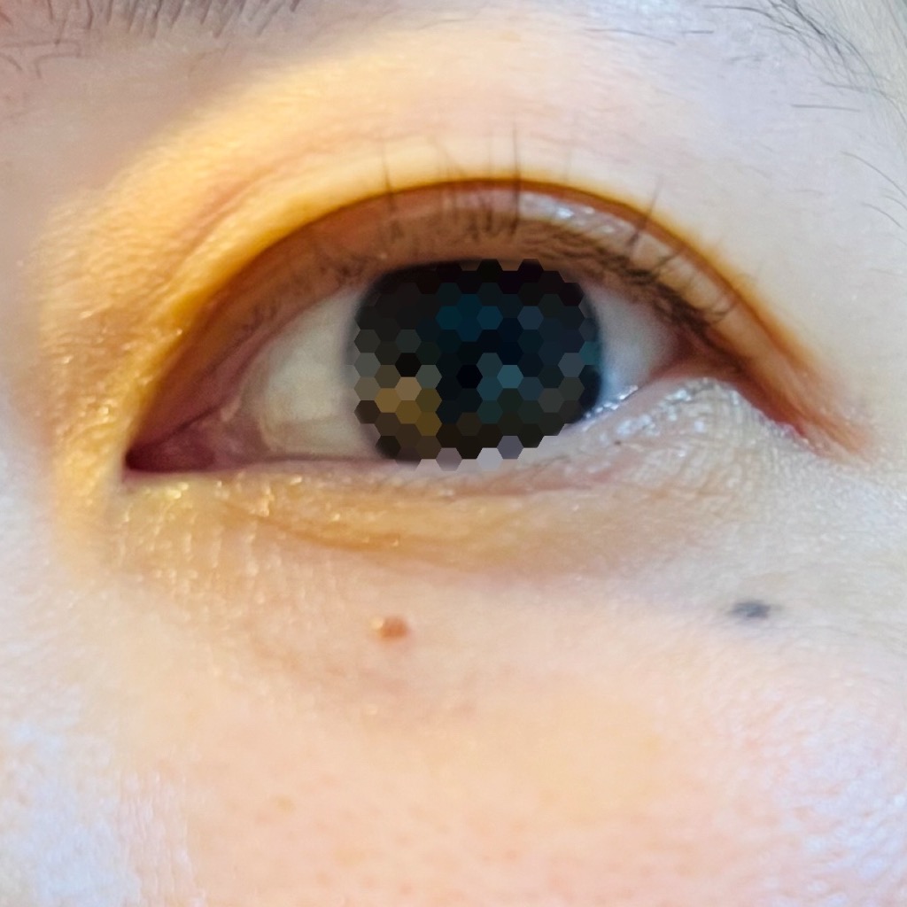 全体のレビュー画像 | 6-0