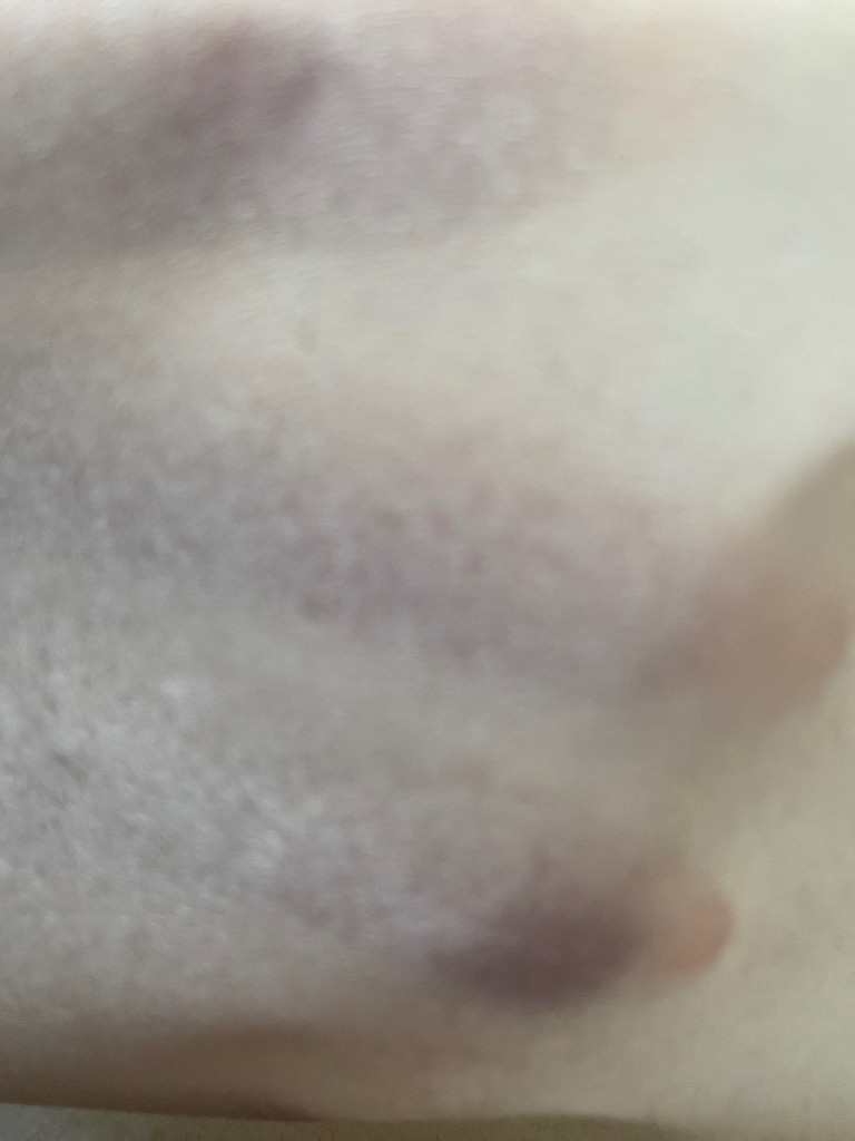 全体のレビュー画像 | 2-1