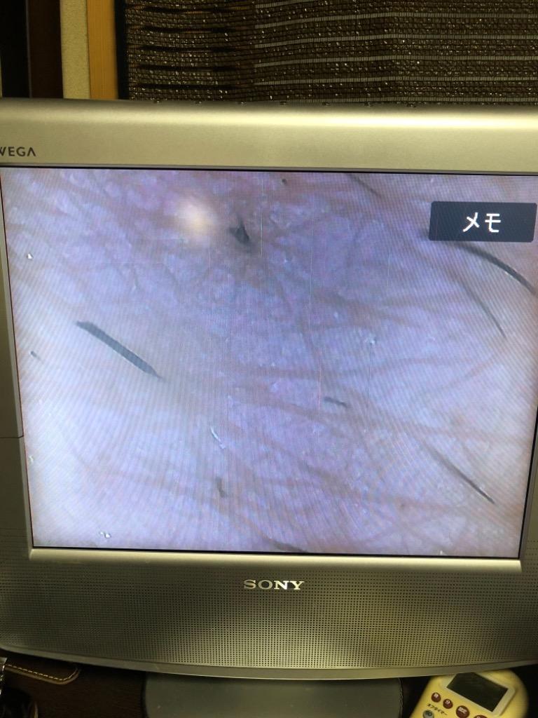 TVマイクロスコープ デジタル顕微鏡 テレビスコープ 最高倍率400