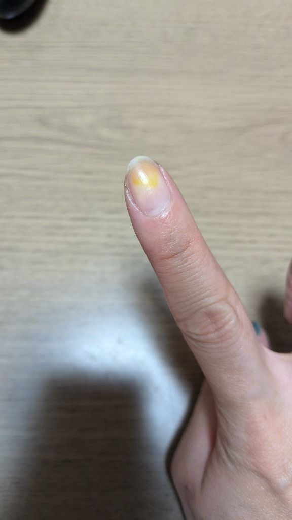 全体のレビュー画像 | 2-1