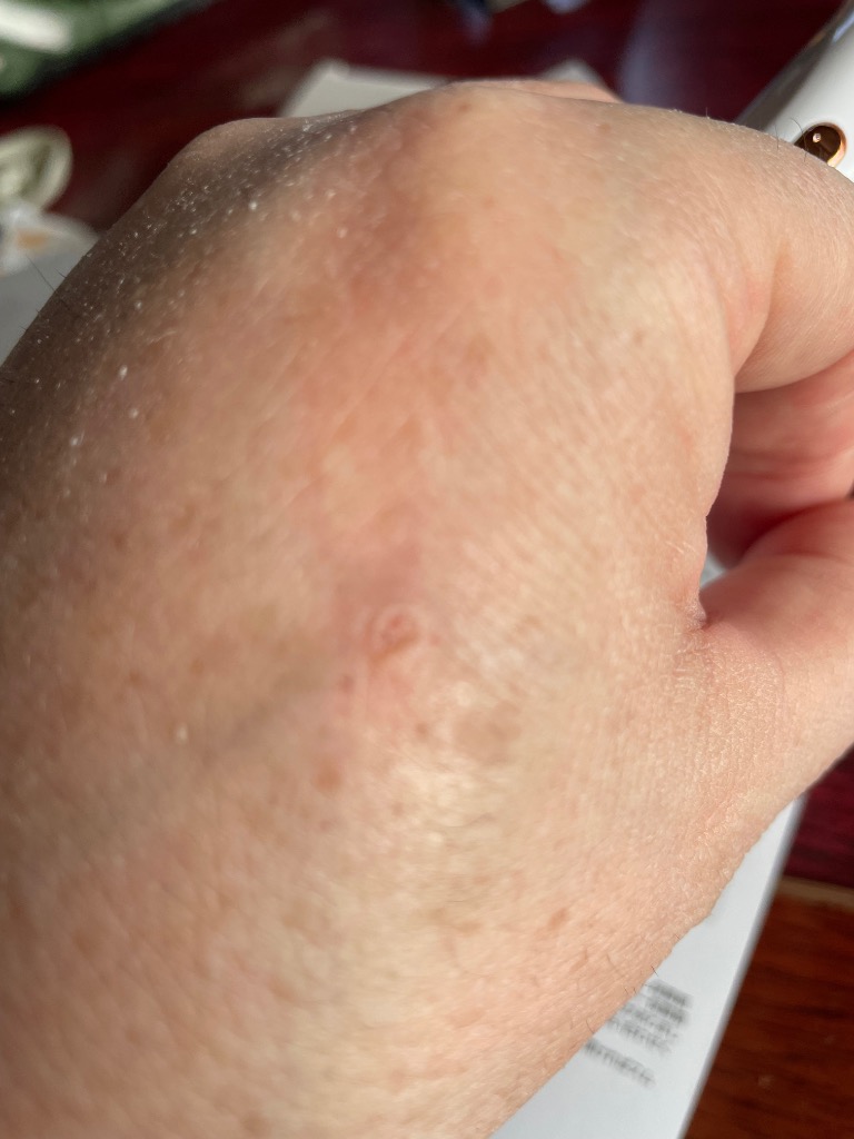 全体のレビュー画像 | 6-2