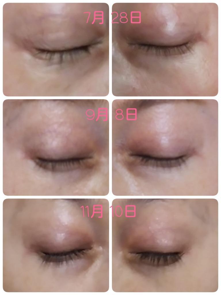 EMAKED エマーキット まつ毛美容液 水橋保寿堂製薬 2ml 正規品