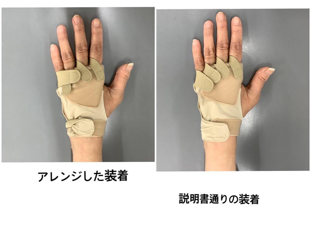 ゆびサポくん 尺側変位 指用サポーター 1枚 1本ずつ指を固定できる手袋